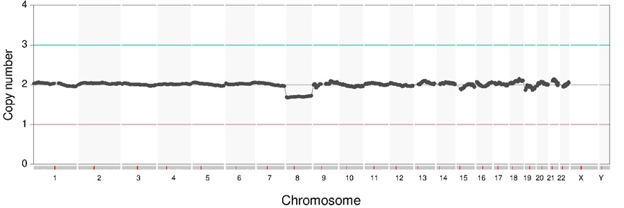 判定B：8番染色体に変化がない細胞と、変化がある細胞が混在している